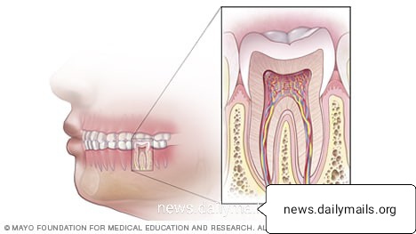 नैनोबोट से होगा दांतो का इलाज