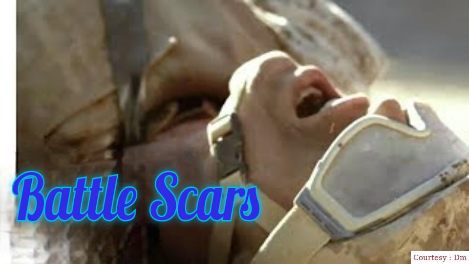 Battle Scars 