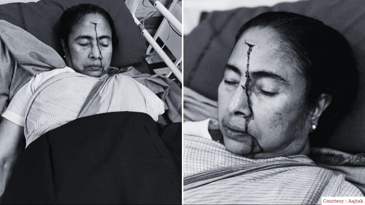 बंगाल सीएम ममता बनर्जी को आई गंभीर चोट।
