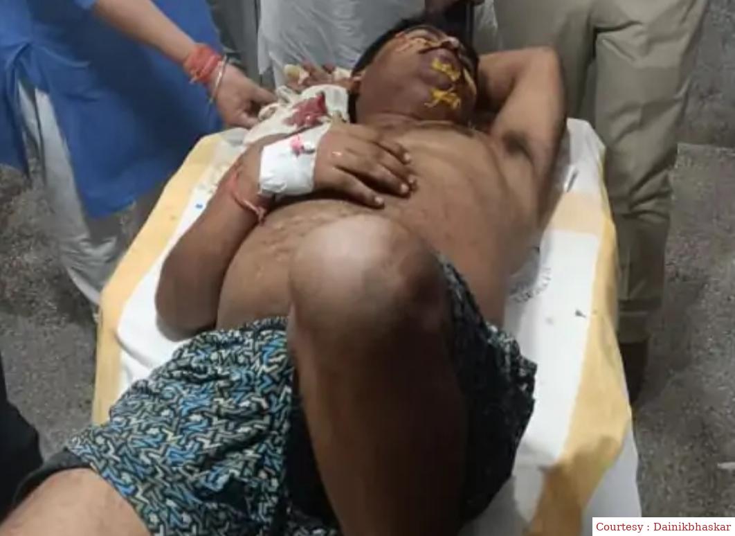 बेगूसराय में घर में घुसकर सीओ को मारा चाकू: गंभीर हालत में चल रहा है इलाज। युवक गिरफ्तार।