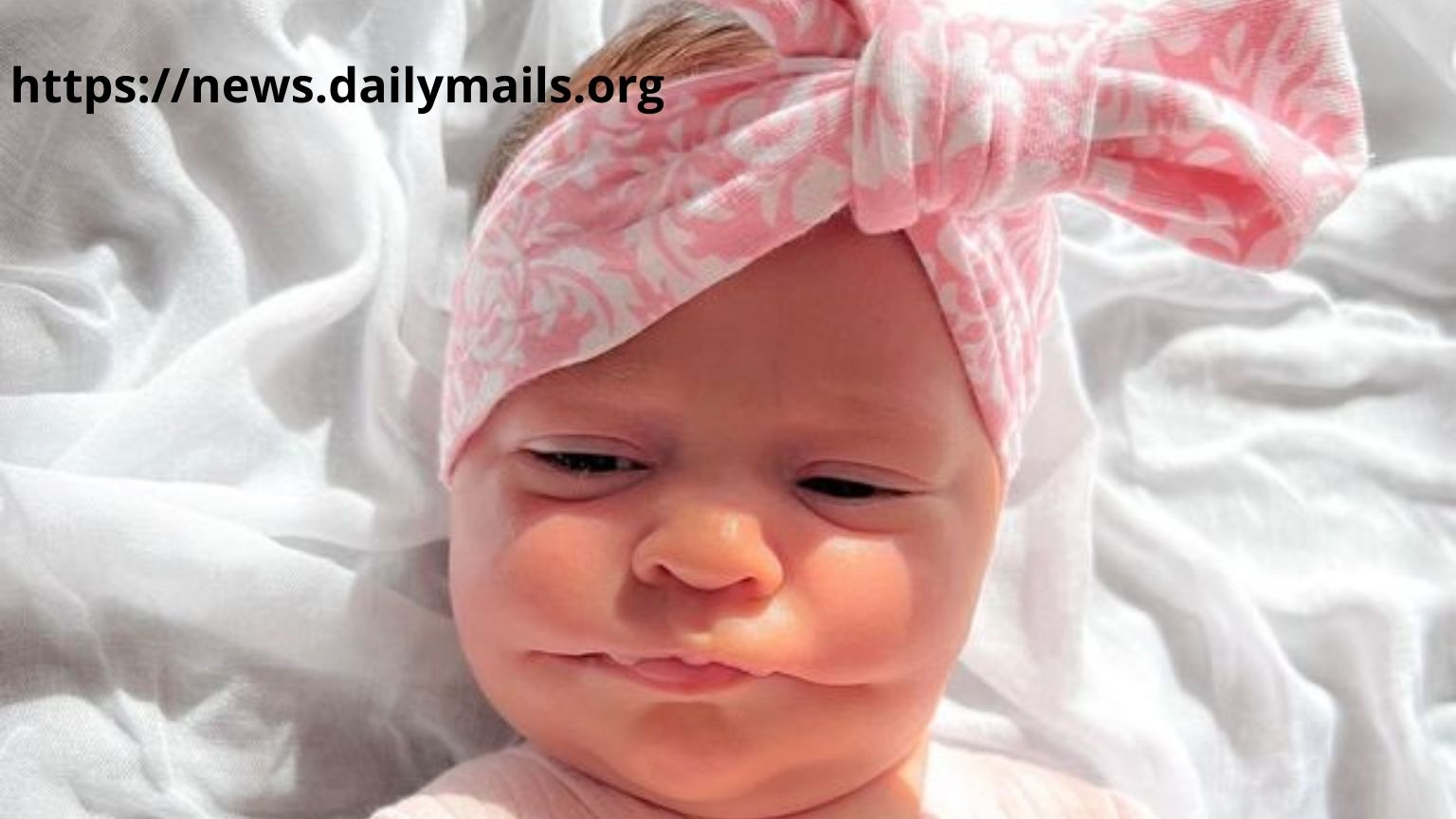 Baby born with permanent smile in Australia due to fatal disease