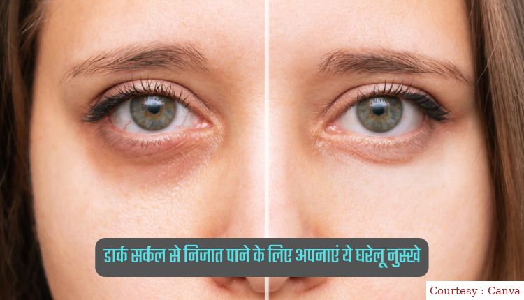 Follow these home remedies to get rid of dark circles