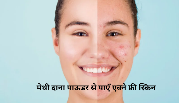 Get acne free skin with fenugreek seeds powder
