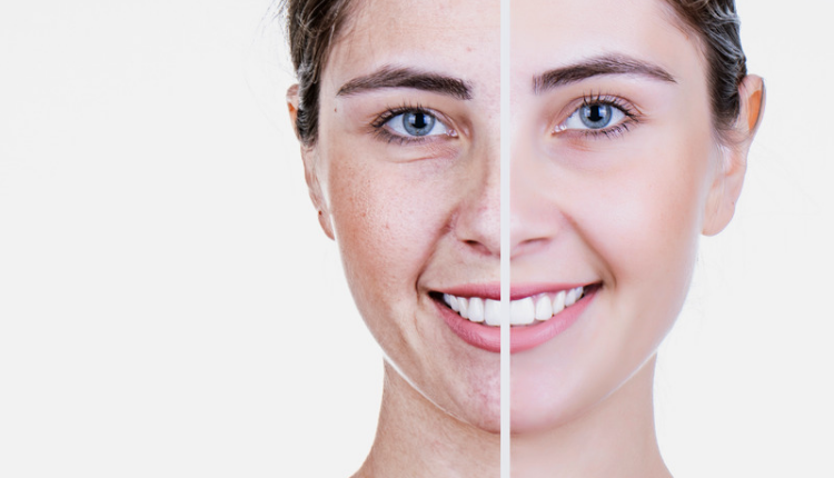 Get rid of sign of aging just from some domestic things