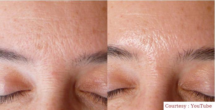 Home remedies to remove dead skin cells from face