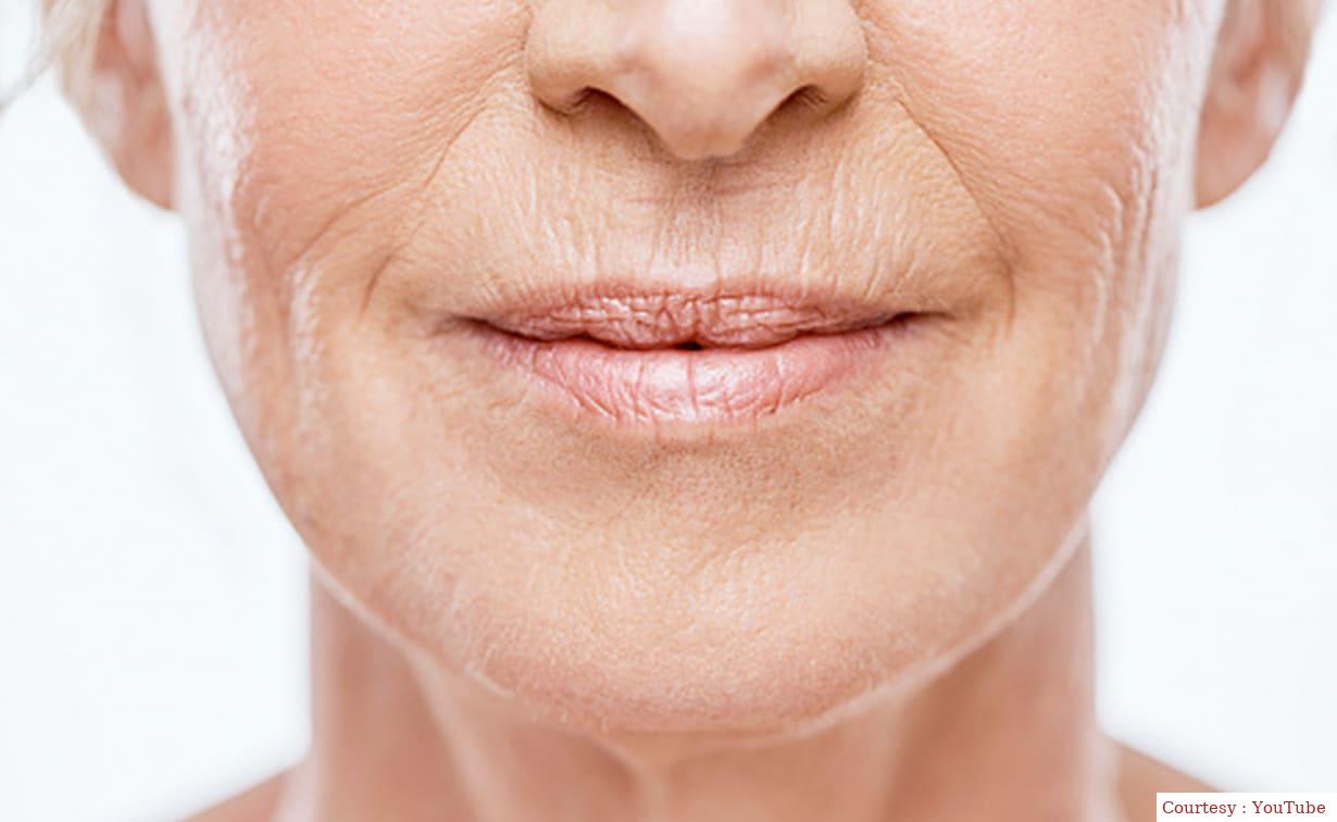 Now the facial wrinkles will disappear easily