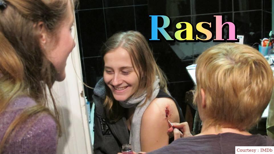 Rash