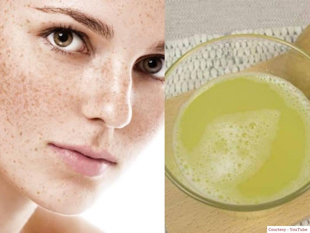 Remove facial stains and pigmentation