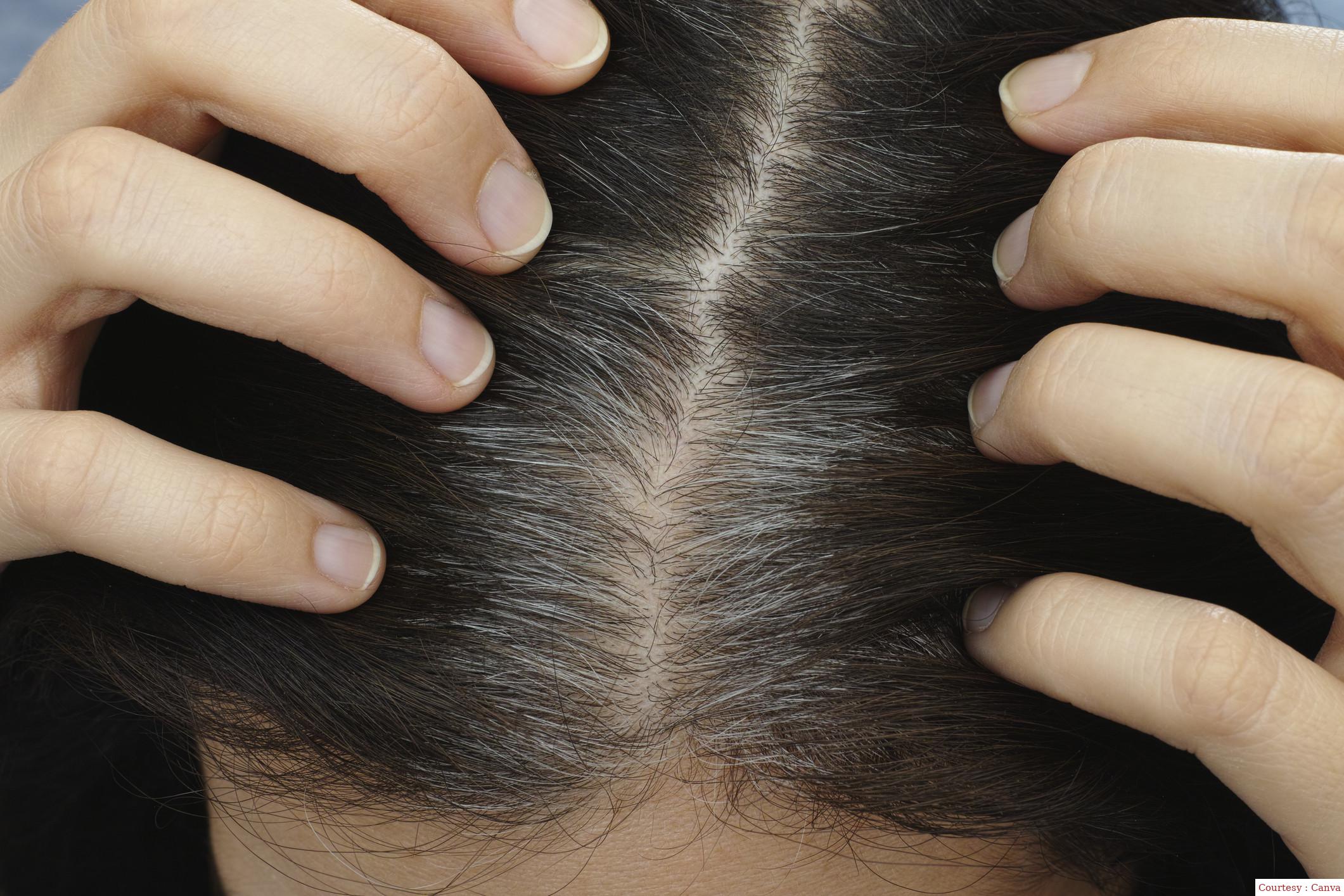 हेयर ग्रेइंग को जड़ से हटाता है आंवला का यह हेयर मास्क