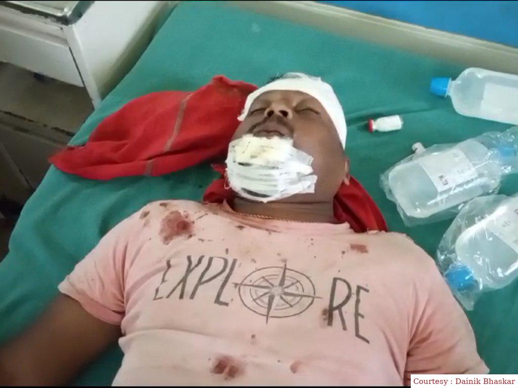 अयोध्या : स्ट्रीट लाइट ठीक करने के दौरान नगर निगम कर्मचारी को लगा करंट, हालत गंभीर।