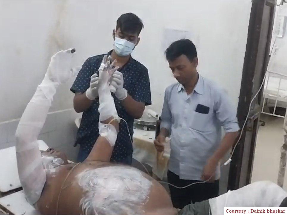 सीवान : दीपक जलाते दौरान दुकान में रखे पेट्रोल में लगी आग, गंभीर रूप से झुलसा दुकानदार।